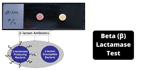 beta lactamase positive h flu|Fighting Beta.